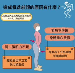 骨盆前傾 – 連邦有限公司
