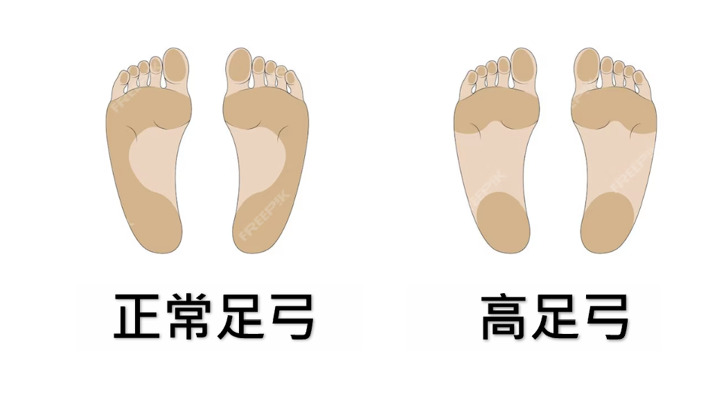 一張含有 文字, 足部穿著, OK 繃 的圖片

自動產生的描述