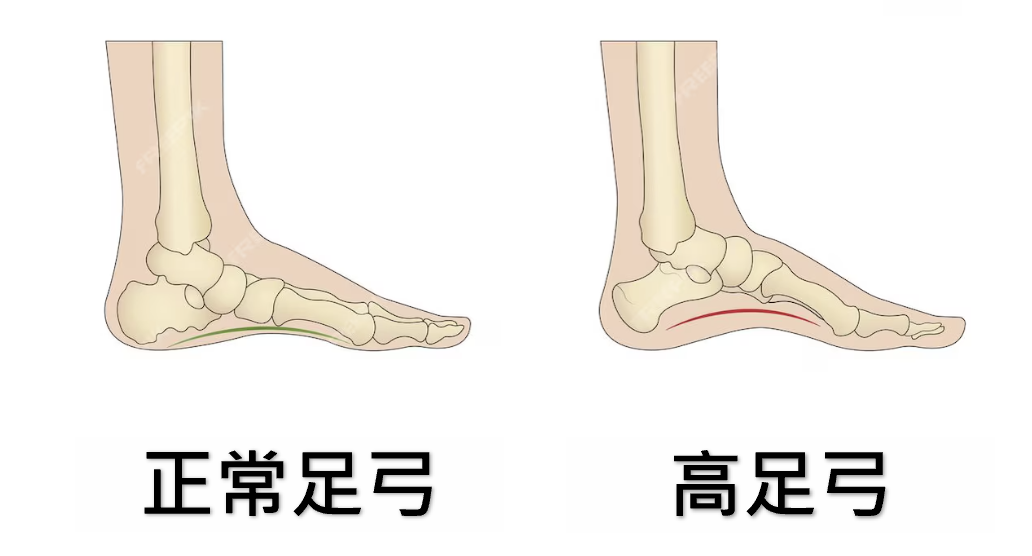 一張含有 足部穿著, 靴子 的圖片

自動產生的描述