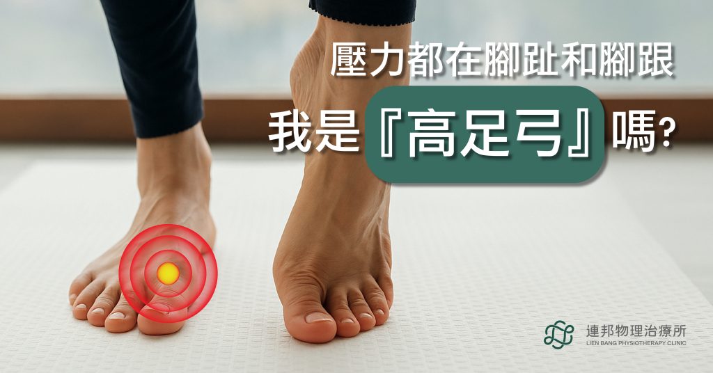 高足弓,物理治療,連邦物理治療所