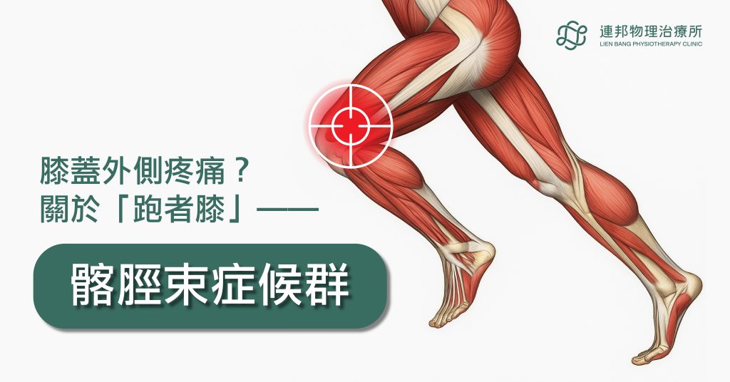 台北物理治療、膝蓋外側痛、跑步膝、過度使用傷害、髂脛束症候群